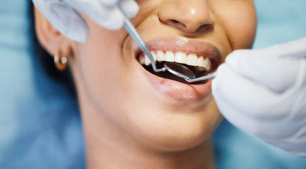 Best Weekend Emergency Dental Services in St Martins, MO