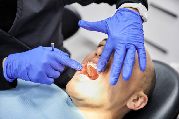 Best Emergency Denture Repair in St Martins, MO